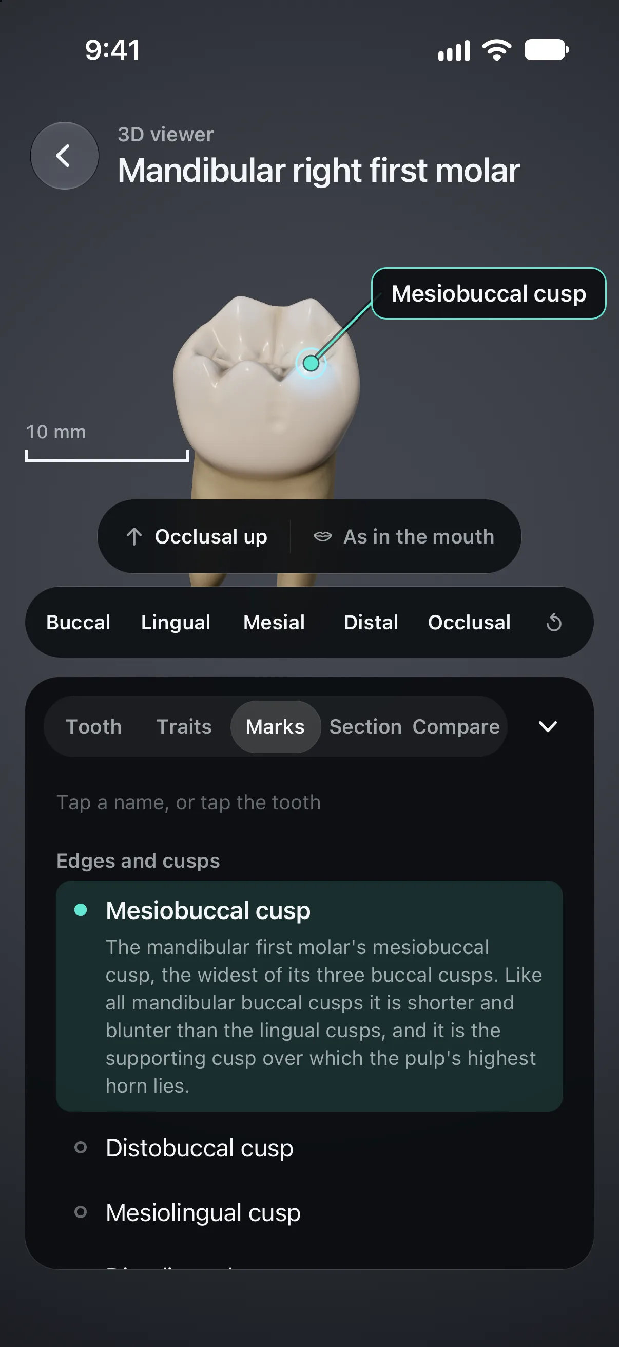 Handpiece 3D viewer on iPhone showing the mandibular right first molar with the mesiobuccal cusp highlighted and explained, and a 10 mm scale bar.